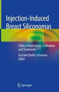 Injection-Induced Breast Siliconomas: Clinical Implications, Evaluation and Treatment