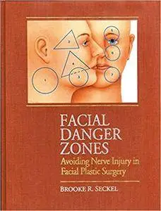 Facial Danger Zones: Avoiding Nerve Injury in Facial Plastic Surgery