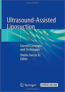 Ultrasound-Assisted Liposuction: Current Concepts and Techniques