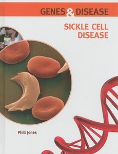 Sickle Cell Disease (repost)