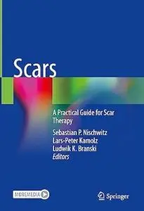 Scars: A Practical Guide for Scar Therapy