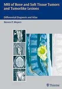 MRI of Bone and Soft Tissue Tumors and Tumorlike Lesions: Differential Diagnosis and Atlas