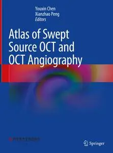 Atlas of Swept Source OCT and OCT Angiography