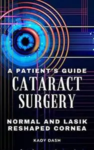 A Patient's Guide to Cataract Surgery : Normal and LASIK Reshaped Cornea