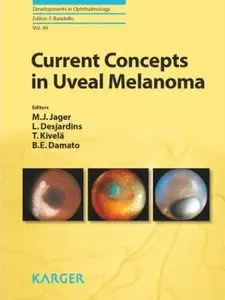 Current Concepts in Uveal Melanoma (repost)