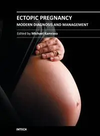 Ectopic Pregnancy – Modern Diagnosis and Management by Michael Kamrava