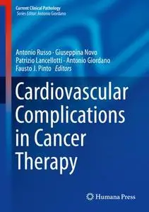 Cardiovascular Complications in Cancer Therapy (Repost)