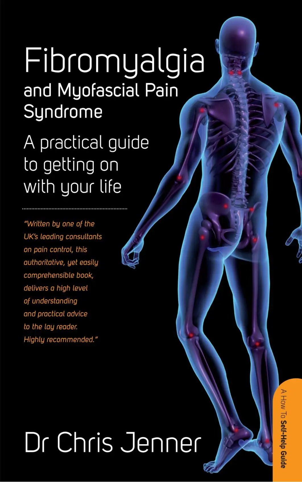 Pain syndrome. Синдром фибромиалгии. Фибромиалгия точки.