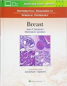 Differential Diagnoses in Surgical Pathology: Breast (repost)