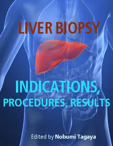 "Liver Biopsy: Indications, Procedures, Results" ed. by Nobumi Tagay
