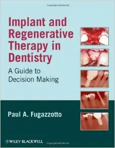 Implant and Regenerative Therapy in Dentistry: A Guide to Decision Making