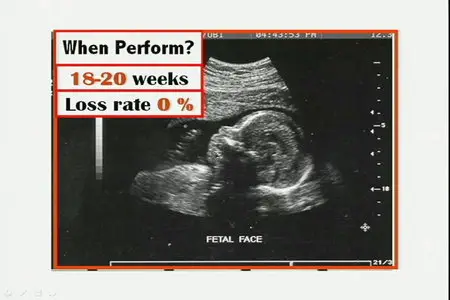 Kaplan 2008 Videos – Obstetrics Second Part