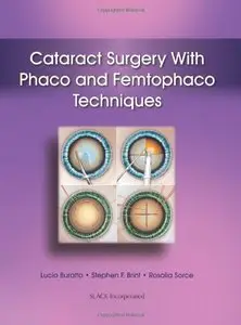 Cataract Surgery With Phaco and Femtophaco Techniques