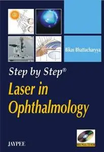 Step by Step Laser in Ophthalmology (Repost)