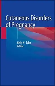 Cutaneous Disorders of Pregnancy