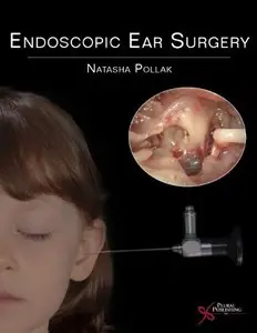 Endoscopic Ear Surgery (repost)