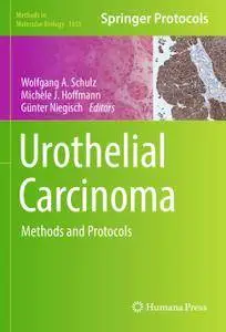 Urothelial Carcinoma