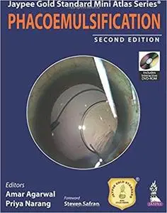 Phacoemulsification (2nd Edition)