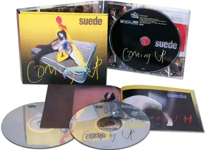 Suede – Coming Up (1996) Deluxe Edition 2011 [2CD + DVD]