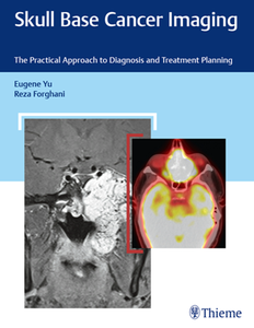 Skull Base Cancer Imaging : The Practical Approach to Diagnosis and Treatment Planning