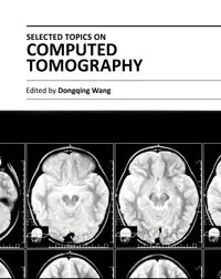 "Selected Topics on Computed Tomography" ed. by Dongqing Wang
