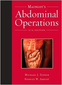 Maingot's Abdominal Operations 11th Edition 2006 (Repost)