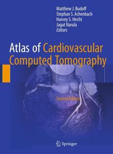 Atlas of Cardiovascular Computed Tomography, Second Edition (Repost)