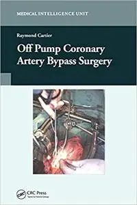 Off Pump Coronary Artery Bypass Surgery