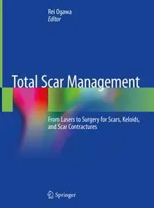 Total Scar Management: From Lasers to Surgery for Scars, Keloids, and Scar Contractures (Repost)