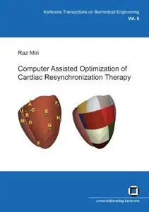 Computer Assisted Optimization of Cardiac Resynchronization Therapy