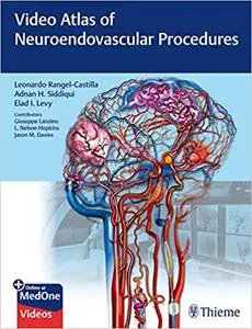 Video Atlas of Neuroendovascular Procedures