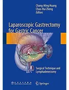 Laparoscopic Gastrectomy for Gastric Cancer: Surgical Technique and Lymphadenectomy [Repost]