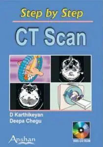 Step by Step CT Scan