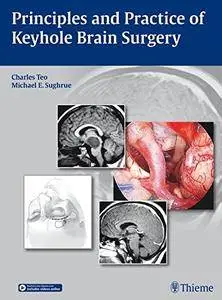 Principles and Practice of Keyhole Brain Surgery