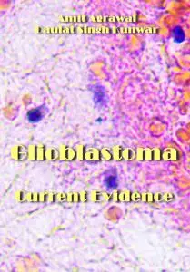 "Glioblastoma: Current Evidence" ed. by Amit Agrawal, Daulat Singh Kunwar