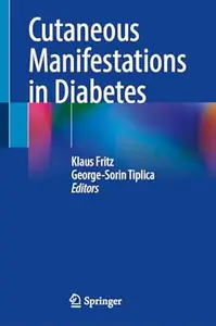 Cutaneous Manifestations in Diabetes