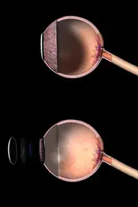 DOSCH DESIGN – 3D: Medical Details – Human Eye