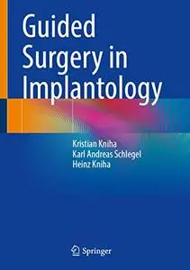 Guided Surgery in Implantology (Repost)
