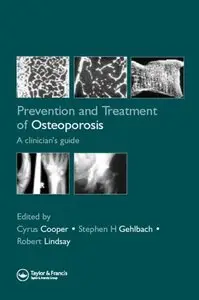 Prevention and Treatment of Osteoporosis in the High-Risk Patient (repost)