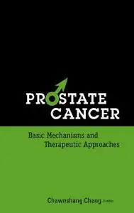 Prostate Cancer: Basic Mechanisms and Therapeutic Approaches (repost)