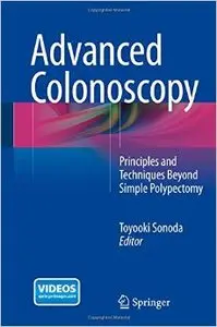 Advanced Colonoscopy: Principles and Techniques Beyond Simple Polypectomy