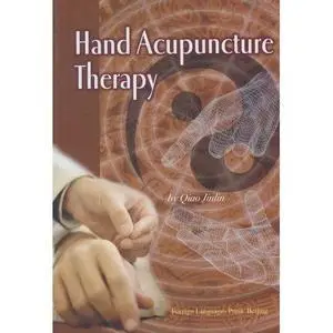 Hand acupuncture therapy