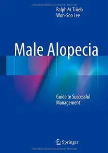 Male Alopecia: Guide to Successful Management