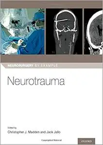 Neurotrauma