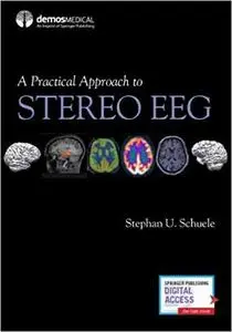 A Practical Approach to Stereo EEG