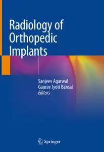 Radiology of Orthopedic Implants (Repost)