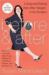 Before & After: Living and Eating Well After Weight-Loss Surgery, Second Revised Edition