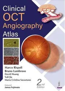 Clinical OCT Angiography Atlas (2nd Edition)