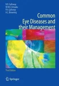 Common Eye Diseases and their Management (Common Eye Diseases and Their Management (Galloway))