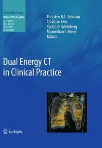 Dual Energy CT in Clinical Practice